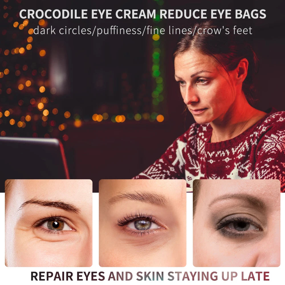 Anti Wrinkle Anti Dark Circles Eye Bags Eye Care