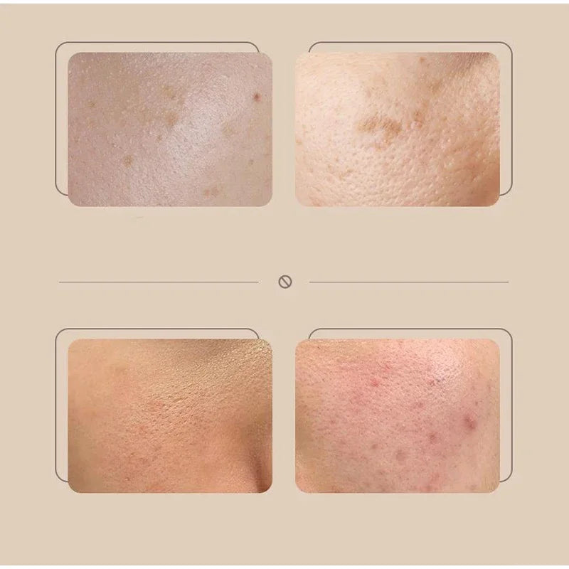 Natural Skin Color Concealer