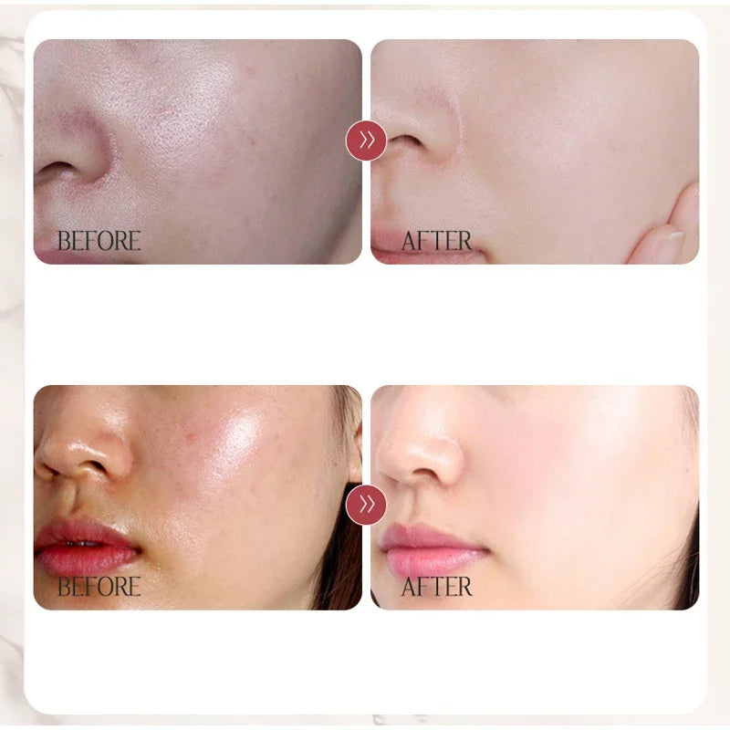 Natural Skin Color Concealer