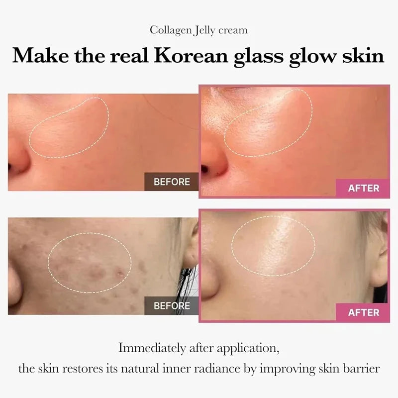 Jelly Face Cream Collagen Soft SPA Nourishing Moisturize Face Shrinks Pores