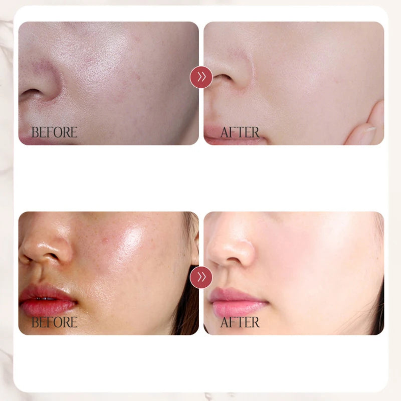 Natural Skin Color Concealer
